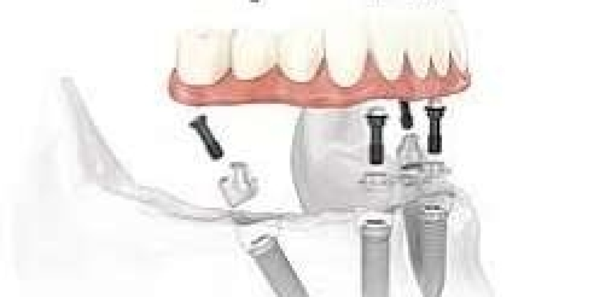 Dental Attend to a normal in addition to Comfortable Giggle